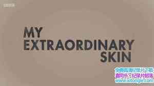 BBC¼Ƭ硪ҵƤ Radio Stories My Extraordinary Skin 2017ӢӢ-