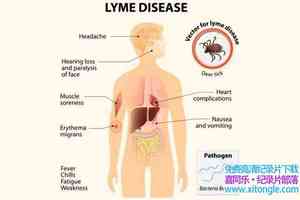 ¼Ƭķ֢ Lyme Disease 2017Ӣ-