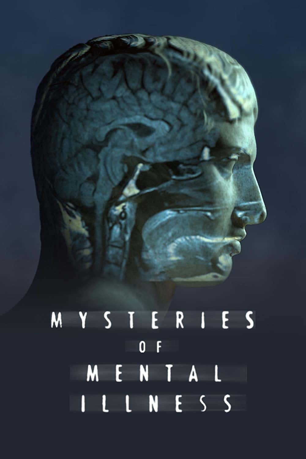 原版纪录片《精神疾病之谜/Mysteries of Mental Illness》S01 WEBRip AAC2 0 x264-BAE 原版无字纪录片解说素材1080高清下载