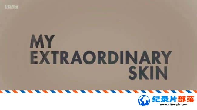 ʷ¼Ƭ硪ҵƤ Radio Stories My Extraordinary Skin 2017ӢӢ-Ѹ