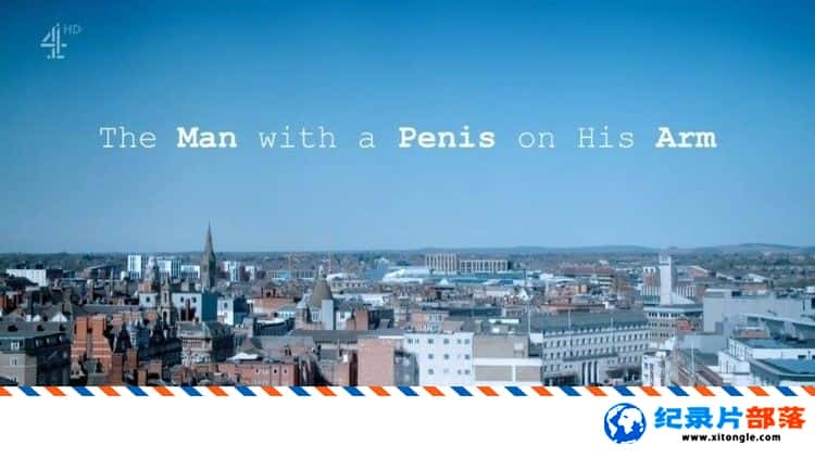 ʷ¼ƬThe Man with a Penis on his Arm ֱϳ 2022ӢӢ-Ѹ