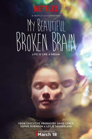 Ƽ¼ƬĴԡ(2016)My Beautiful Broken Brain-Ѹ