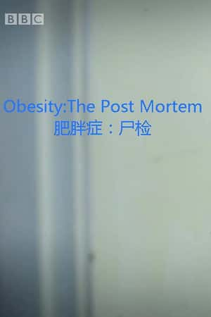 Ƽ¼Ƭʷ֡(2016)Obesity: The Post Mortem-Ѹ