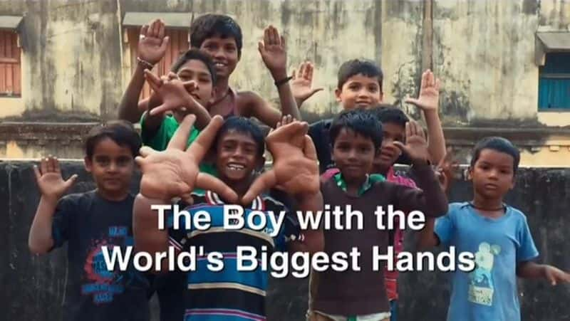 ¼Ƭ޴Ƶк/The Boy with Giant Hands-Ļ