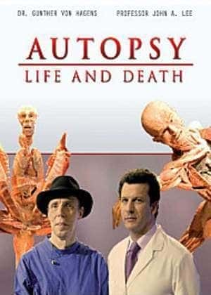 ¼Ƭʬ - /Autopsy - Life and Death-Ļ