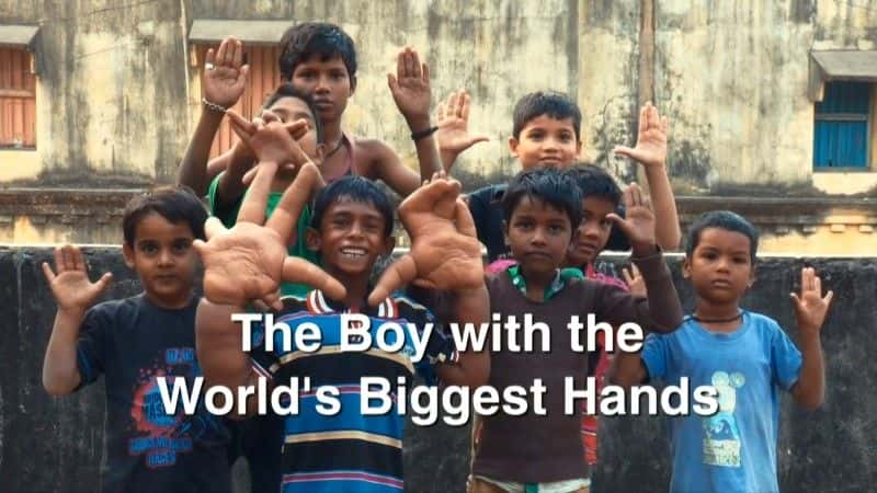 ¼Ƭ޴Ƶк/The Boy with Giant Hands-Ļ