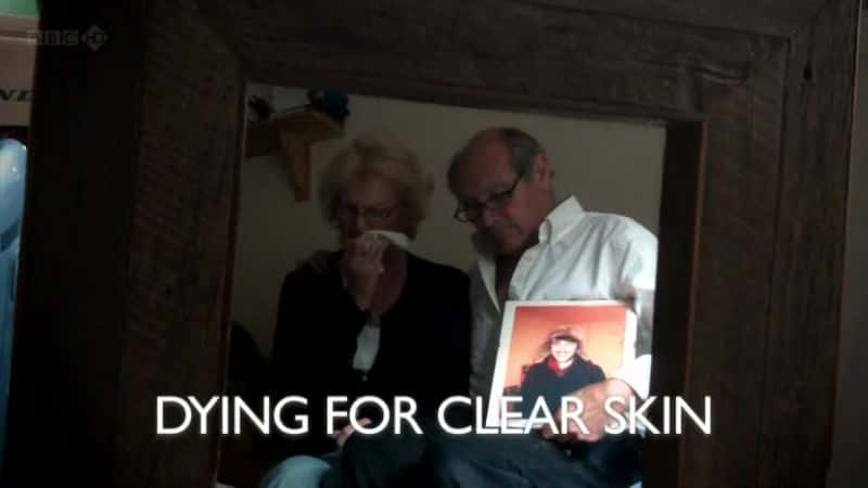 ¼ƬΪƤ/Dying for Clear Skin-Ļ