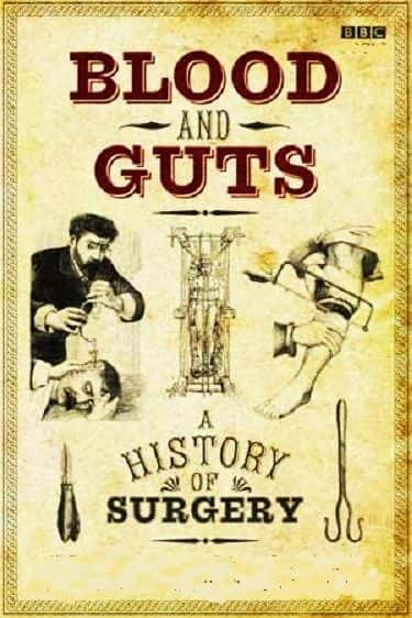 ¼ƬѪ壺ʷ/Blood and Guts: A History of Surgery-Ļ