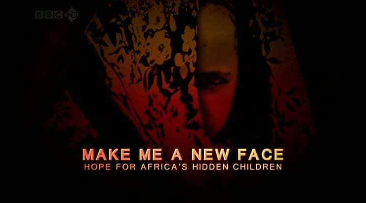 ¼Ƭһ - صĶͯϣ/Make Me a New Face - Hope for Africa's Hidden Children-Ļ