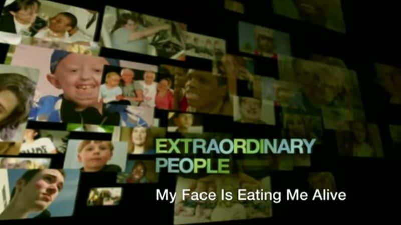 ¼Ƭҵ/My Face is Eating Me Alive-Ļ