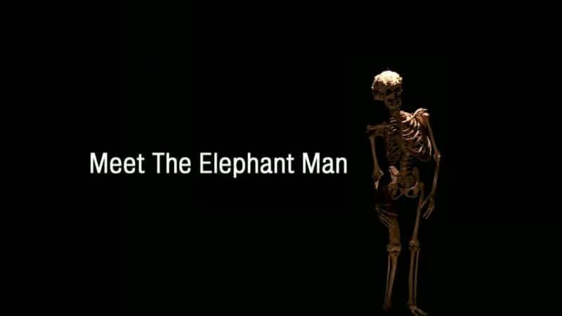 ¼Ƭ/Meet the Elephant Man-Ļ