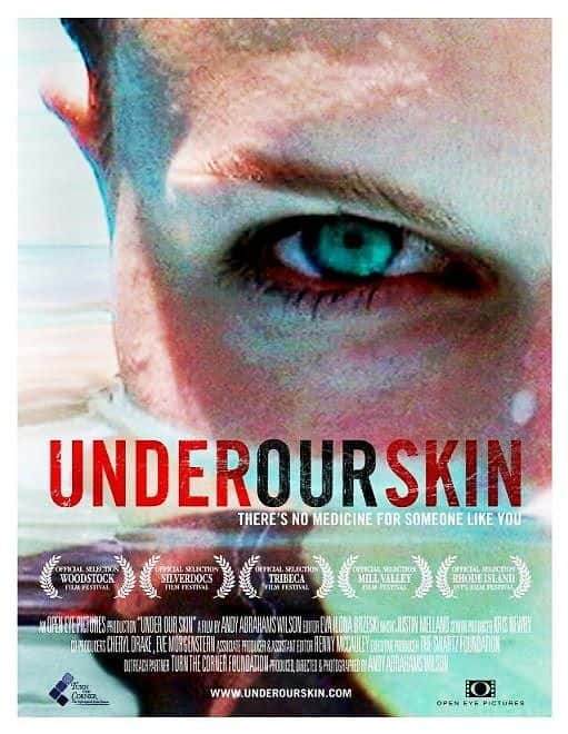 ¼ƬǵƤ/Under Our Skin-Ļ