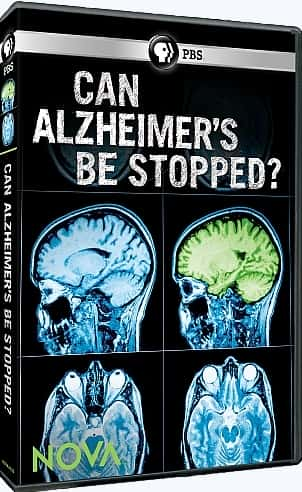 ¼ƬĺĬֹܱ/Can Alzheimer's be Stopped-Ļ