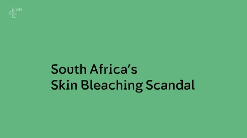 ¼ƬϷǵƤƯ׳/South Africa's Skin Bleaching Scandal-Ļ