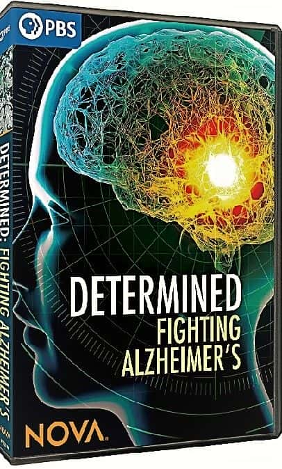 ¼ƬNOVA495֣밢ĺĬ/NOVA: Series 49 Part 5 Determined Fighting Alzheimers-Ļ