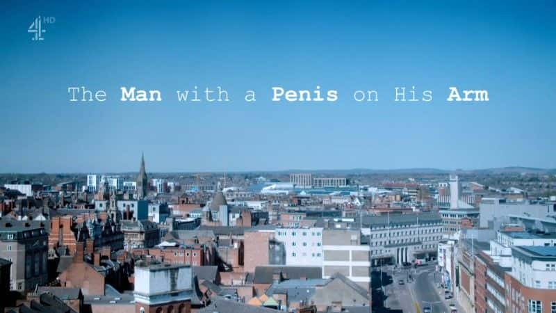 ¼Ƭֱ/The Man with a Penis on his Arm-Ļ