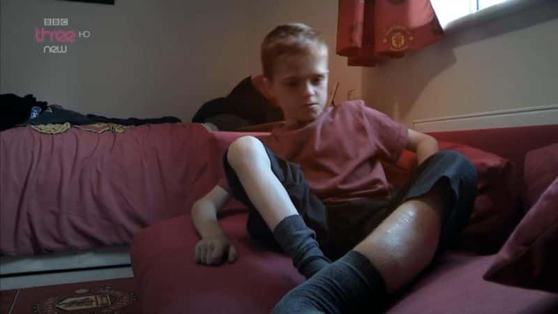 ¼ƬҪȵк The Boy who Wants his Leg Cut OffĻ/Ļ