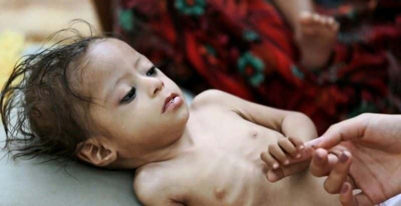 ¼ƬͻͻңҲŵ Conflict and Cholera: Yemen's Catastropheȫ1-Ļ/Ļ