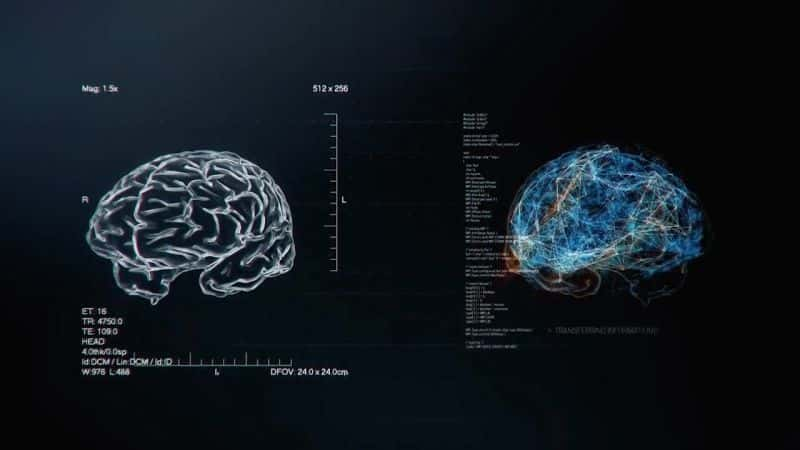 ¼ƬԹ Brain FactoryĻ/Ļ