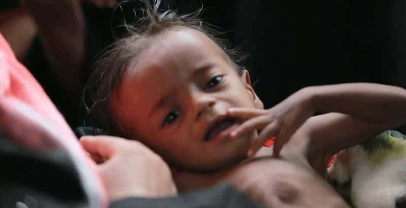 ¼ƬͻͻңҲŵ Conflict and Cholera: Yemen's Catastropheȫ1-Ļ/Ļ