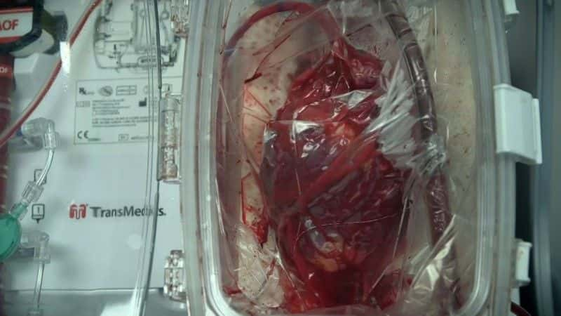 ¼ƬֲȥĻ Heart Transplant: A Chance to LiveĻ/Ļ