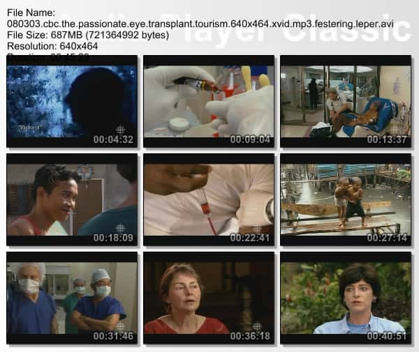 纪录片《移植旅游 Transplant Tourism》[无字] [BT][DVD画质]资源下载