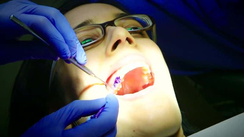 纪录片《关于你牙齿的真相 The Truth about Your Teeth》[无字][BT][720P]资源下载