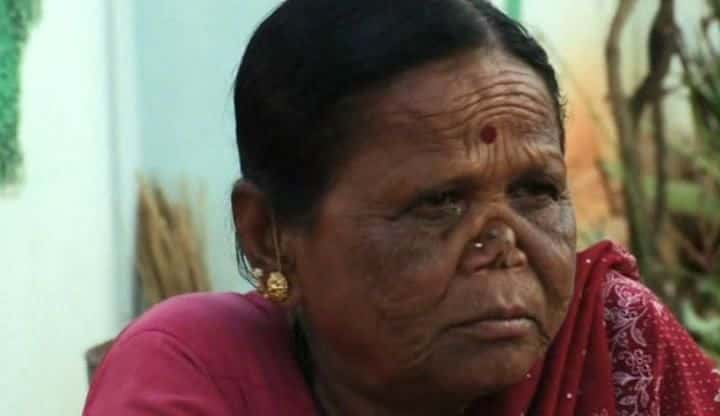 ¼Ƭӡȵ粡Ӣ India's Leprosy Heroesȫ1-Ļ/Ļ