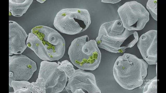 ¼Ƭ΢ǺĿ Microorganisms: The Air We Breathe1080Pȫ1-Ļ/Ļ