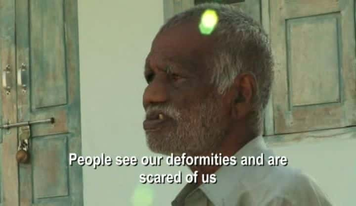 ¼Ƭӡȵ粡Ӣ India's Leprosy Heroesȫ1-Ļ/Ļ