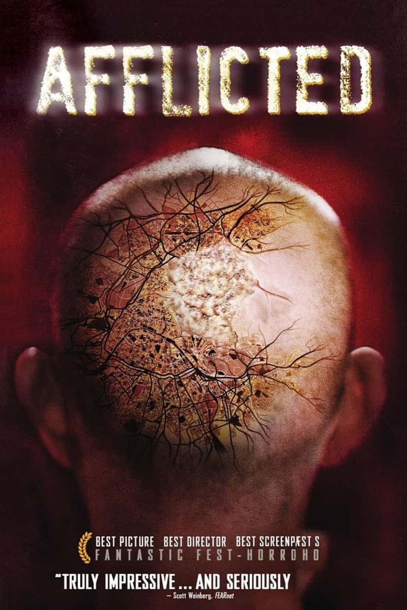 Netflix¼Ƭֲʵ Afflicted 2018-Ѹ