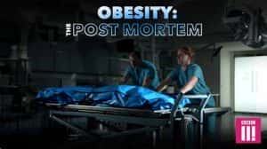 BBC人体健康纪录片《解剖肥胖 / 肥胖症：尸检 Obesity: The Post Mortem》全1集 720P/1080i高清纪录片资源-高清标清1080P720P360P迅雷BT网盘下载