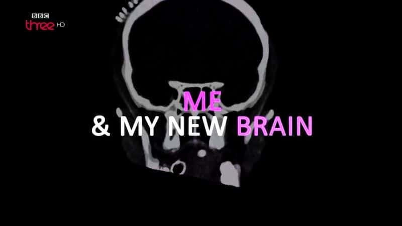 外语原版纪录片《 Me and My New Brain 》 - 纪录片1080P/720P/360P高清标清网盘迅雷下载