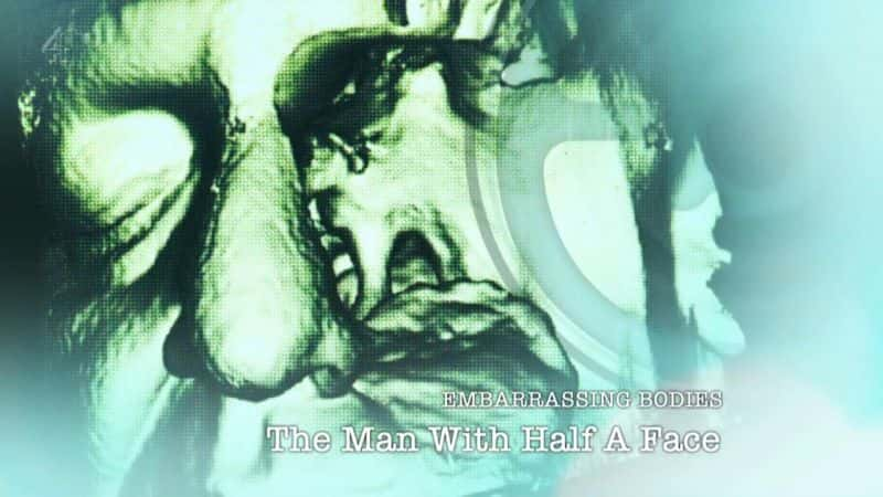 外语原版纪录片《半边脸男人/The Man with Half a Face 》原版无字/外挂字幕 - 纪录片1080P/720P/360P高清标清网盘迅雷下载