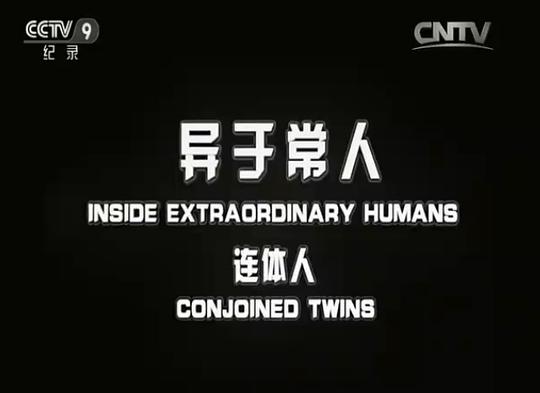 纪录片《异于常人：连体人》（2007美国）--高清4K/1080P迅雷BT资源下载