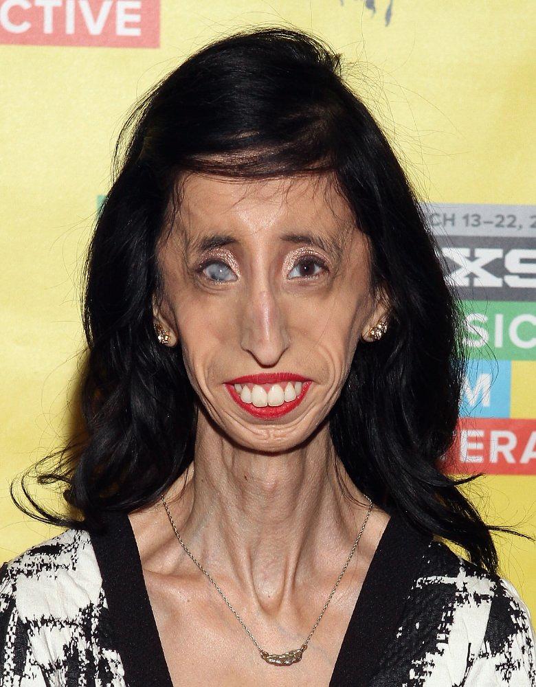 纪录片《勇敢的心：维拉斯克兹的故事  A Brave Heart: The Lizzie Velasquez Story》（2015美国）--高清4K/1080P迅雷BT资源下载