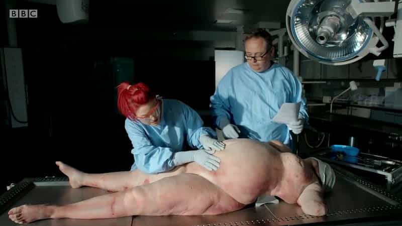 纪录片《解剖肥胖  Obesity: The Post Mortem》（2016英国）--高清4K/1080P迅雷BT资源下载