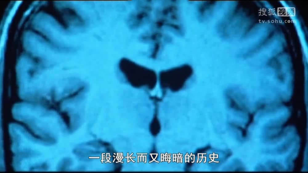 BBC纪录片《大脑：神秘的历史 The Brain:A Secret History 2011》[全3集][中字][720P][网盘][资源下载]