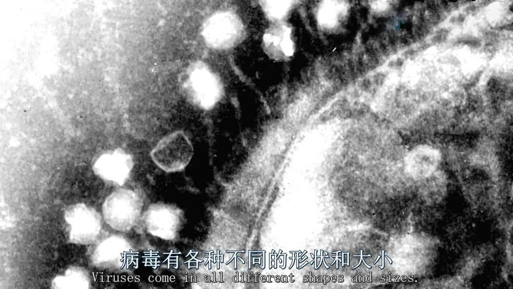 BBC纪录片《病毒为何致命 Why Do Viruses Kill 2010》[全1集][无字幕][外挂字幕][720P][网盘][资源下载]