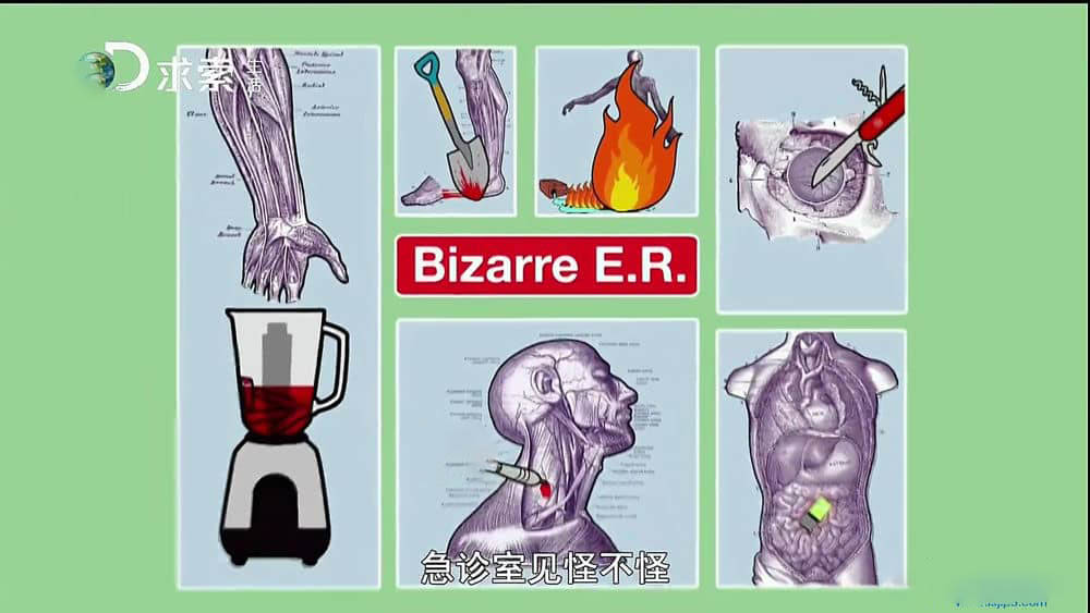 探索频道纪录片《急诊室见怪不怪》[全5集][中字][1080P][网盘][资源下载]